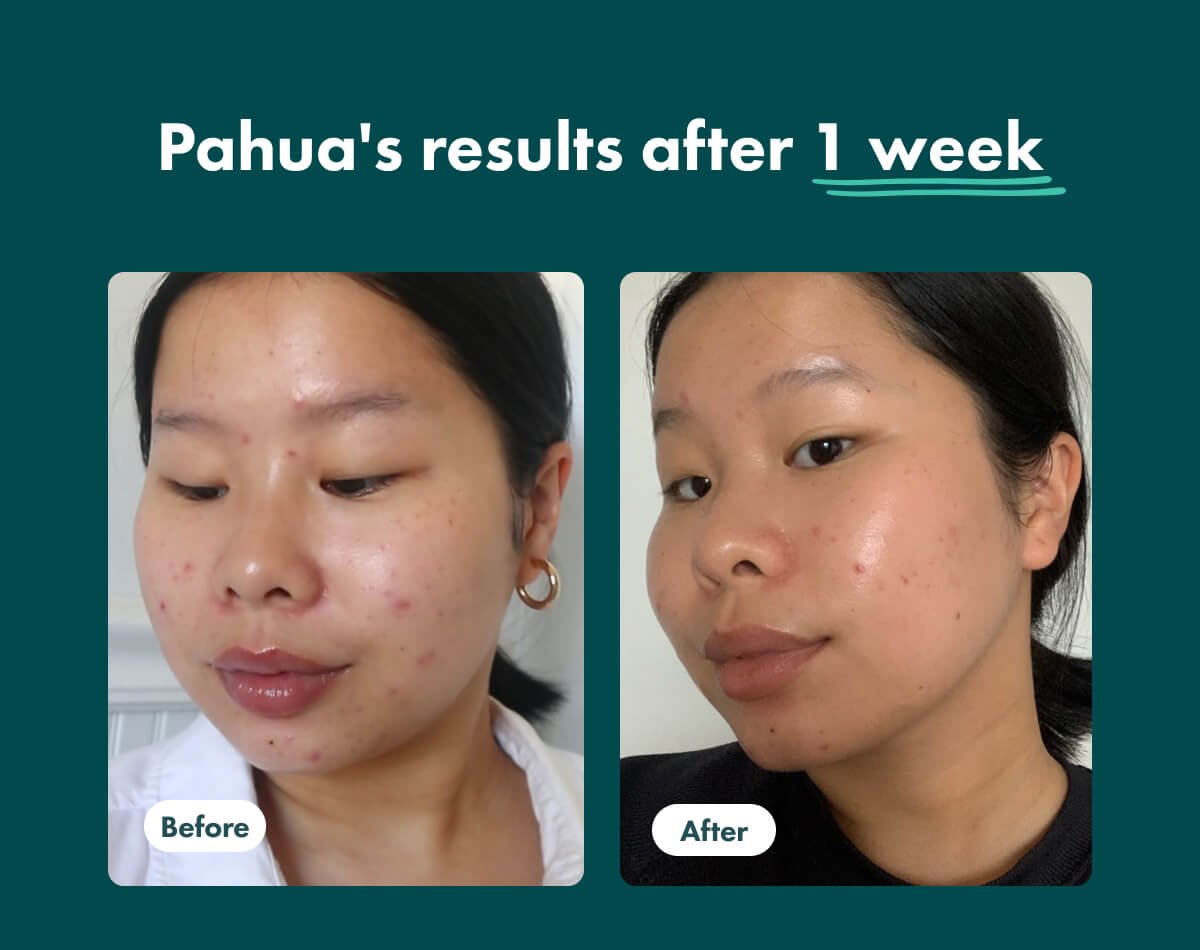 Pahua's results after 1 week