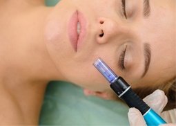 Up to 68% Off Microneedling and PRP at Skinovatio Medical Spa