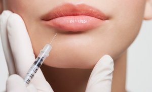 Restylane Injections