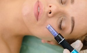 Microneedling and PRP Treatment
